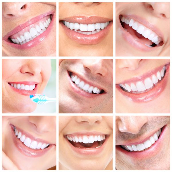 زن و مرد خندان زیبا سلامت دندان