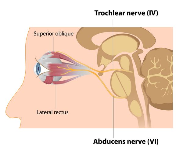 اعصاب Trochlear و Abducens