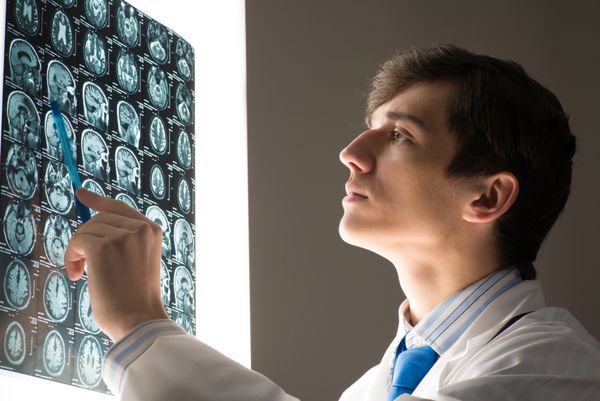 دکتر مرد که به تصویر اشعه ایکس متصل به صفحه نمایش درخشان نگاه می کند