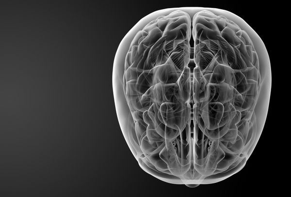 اشعه ایکس مغز انسان - نمای بالا