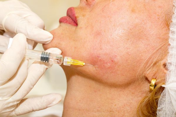 درمان زیبایی با تزریق بوتاکس در کلینیک