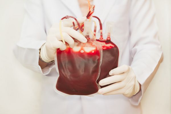 دکتری که خون اهداکننده تازه را برای انتقال خون در دست دارد