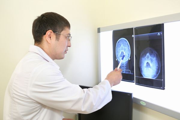دکتر عکس اشعه ایکس از بیمارش را معاینه می کند