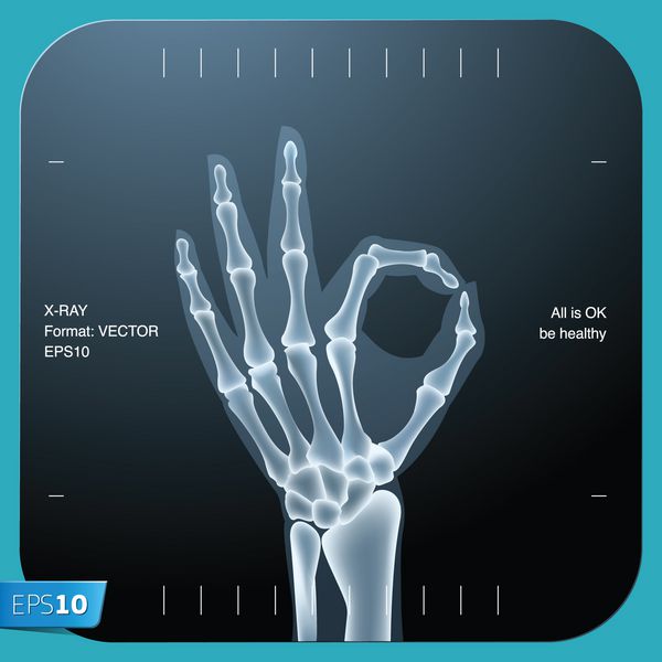 اشعه ایکس هر دو دست انسان خوب وکتور illustration
