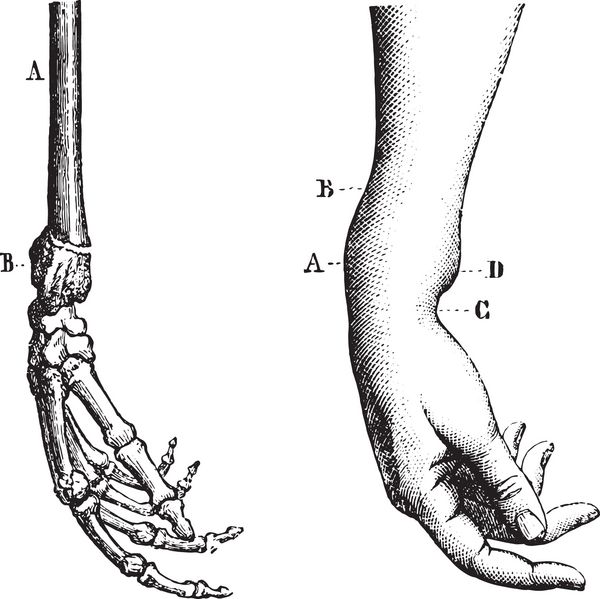 شکستگی اندام تحتانی شعاع تصویر حکاکی شده قدیمی فرهنگ لغت پزشکی ایالات متحده توسط دکتر لث - 1885