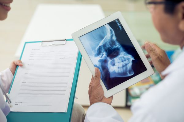نمای نزدیک از پزشکان در حال معاینه اشعه ایکس جمجمه
