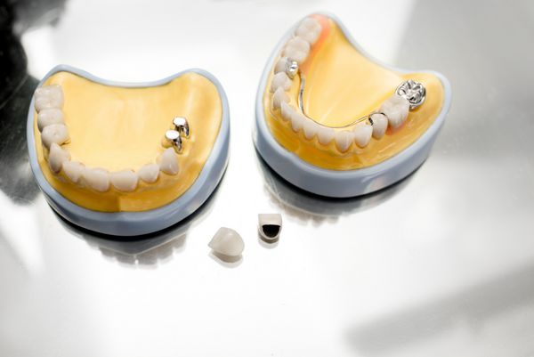 مواد مختلف دندانپزشکی در مطب دندانپزشکی