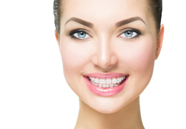brs لبخند زن زیبا از نزدیک لبخند سالم کلوزآپ brs سرامیکی روی دندان لبخند زنانه زیبا با brs درمان ارتودنسی مفهوم مراقبت از دندان هم ترازی دندان ها