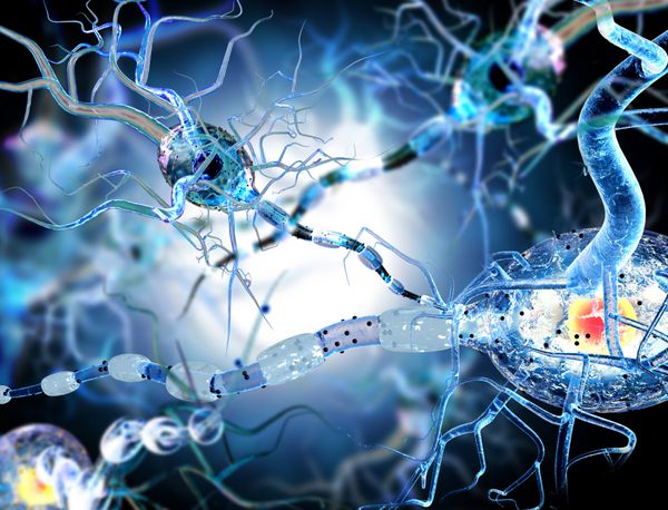 تصویر سه بعدی از سلول های عصبی مفهوم بیماری های عصبی تومورها و جراحی مغز
