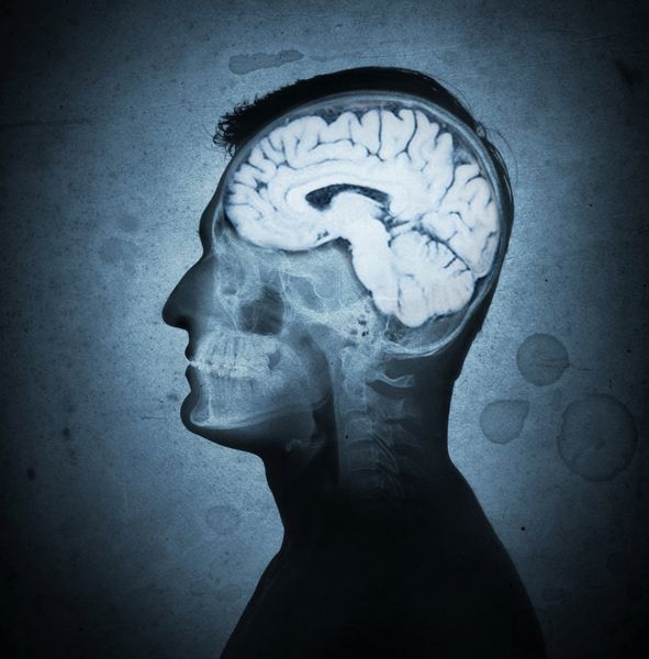 تصویر مفهومی از یک مرد از نمای جانبی که فعالیت مغز و مغز را نشان می دهد یکپارچهسازی با سیستمعامل قدیمی