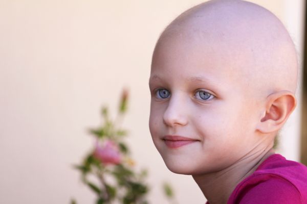 کودک زیبا مبتلا به سرطان و ریزش مو به دلیل شیمی درمانی