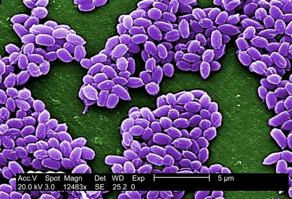 اسپورهای ناشی از باکتری سیاه زخم این هاگ‌ها سال‌ها زندگی می‌کنند و باکتری‌ها را قادر می‌سازند در حالت خفته زنده بمانند po by Janice Haney Carr 2002