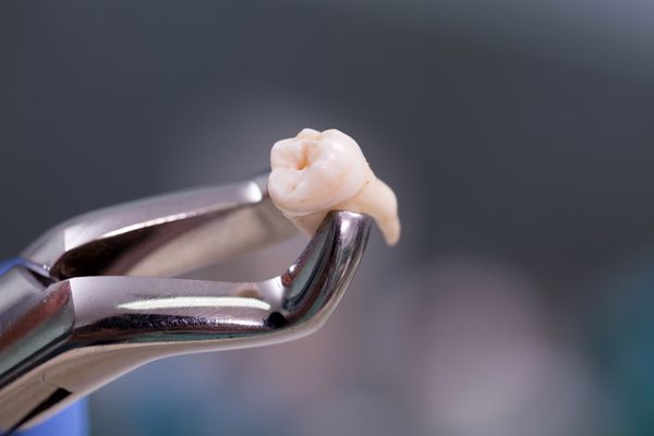 تجهیزات دندانپزشکی کشیدن دندان