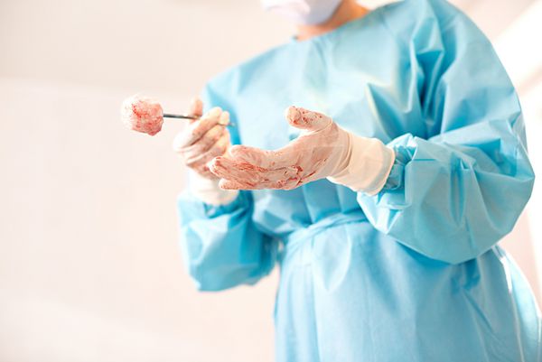 یک زن جراح در اتاق عمل دست در دستکش پزشکی دست پرستار با دستکش