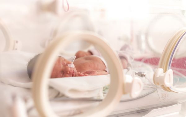 نوزاد نارس در انکوباتور بیمارستان پس از سزارین در هفته 33