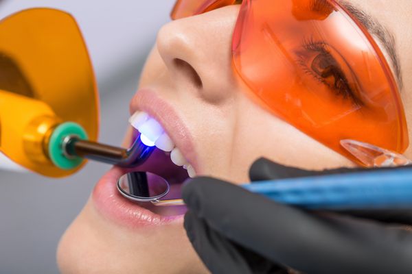 عکس ماکرو از درمان دندانپزشکی