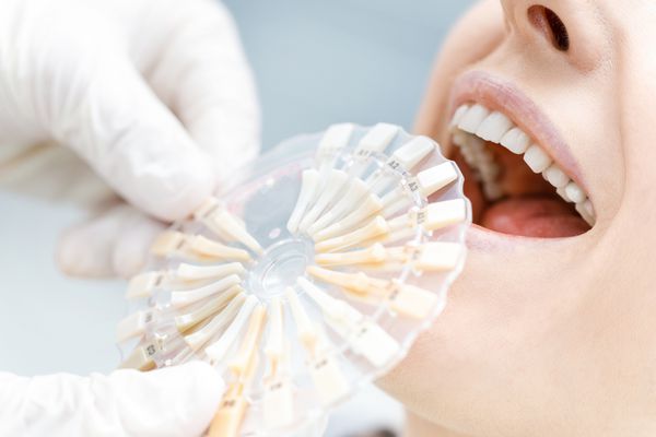 نمای نزدیک از دندانپزشک در حال مقایسه دندان های بیمار با نمونه ها
