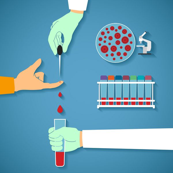 مفهوم برداری از آزمایش خون مشترک