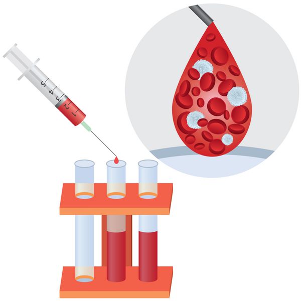 سرنگ با خون انسان و لوله های آزمایش برای آزمایش خون