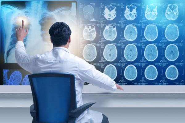 دکتر مذکر به دنبال اسکن MRI است