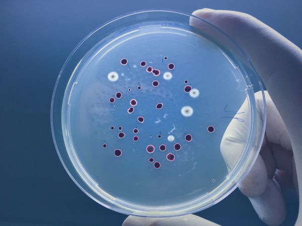 صفحه آگار کامل باکتری های میکرو و میکروارگانیسم ها