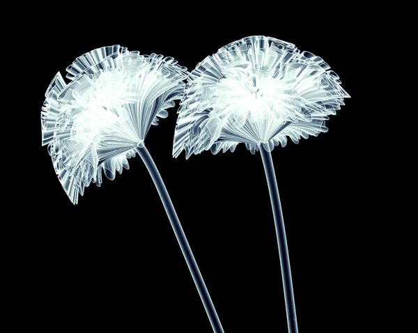 تصویر اشعه ایکس از یک گل جدا شده بر روی سیاه و سفید تصویر coxcomb 3D