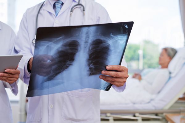اشعه ایکس قفسه سینه در دست کارگر پزشکی