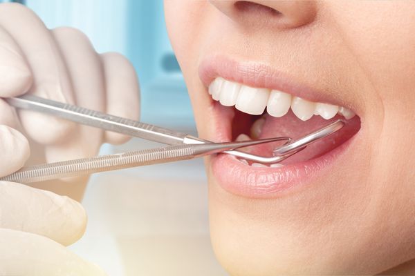 معاینه دندان در دندانپزشکان