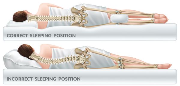 بالش ارتوپدی برای زانوها پاهای موقعیت خواب صحیح و نادرست ایزوله شده بردار 3D واقع گرایانه
