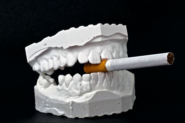 مدل برداشت دندان با سیگار