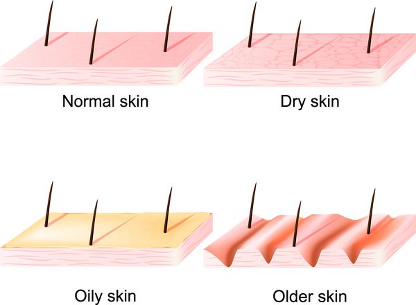 پوست طبیعی خشک و روغنی جوانتر و مسن تر است ناهمسان انواع پوست و شرایط انسانی نمای مقطعی
