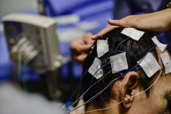 قرار دادن الکترود EEG به بیمار در طول ضبط EEG الکتروانسفالوگرام EEG