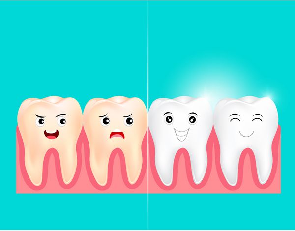 روکش های دندان روی دندان انسان قبل و بعد سفید کردن مفهوم مراقبت از دهان تمیز کردن عمیق پاکسازی روند دندان تصویر بر روی زمینه سبز
