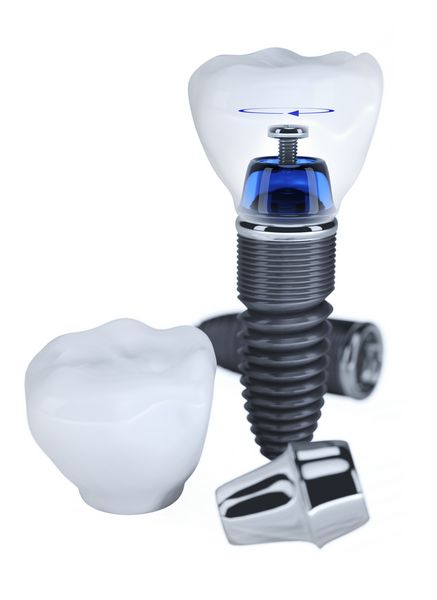 ساخت پروتز دندان جدا شده بر روی رنگ سفید