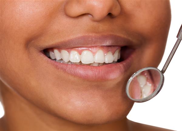 دندان های زن سالم جدا شده روی پس زمینه سفید