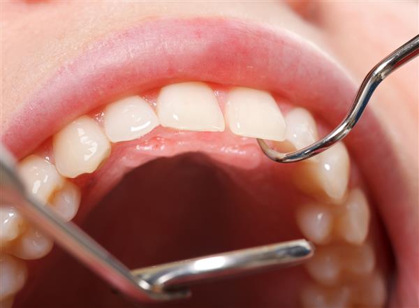 معاینه دوره ای جامع دندانپزشکی برای داشتن دهان و دندان سالم