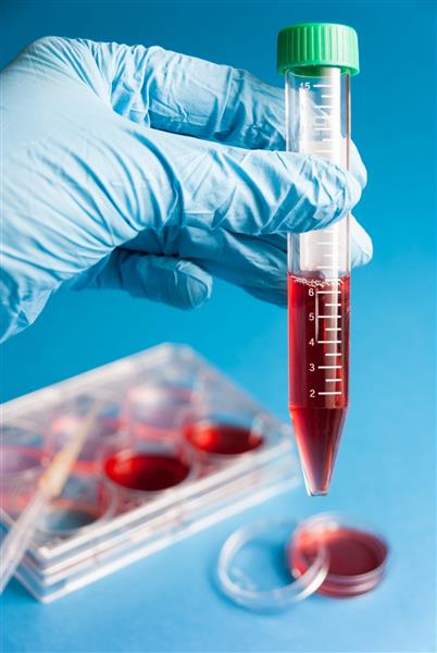 بیوشیمی آزمایش خون کشت سلولی برای تشخیص پزشکی دست با دستکش لوله را با تجزیه و تحلیل خون روی زمینه آبی نگه داشته است آزمایشگاه های پلاستیکی برای تحقیقات علمی