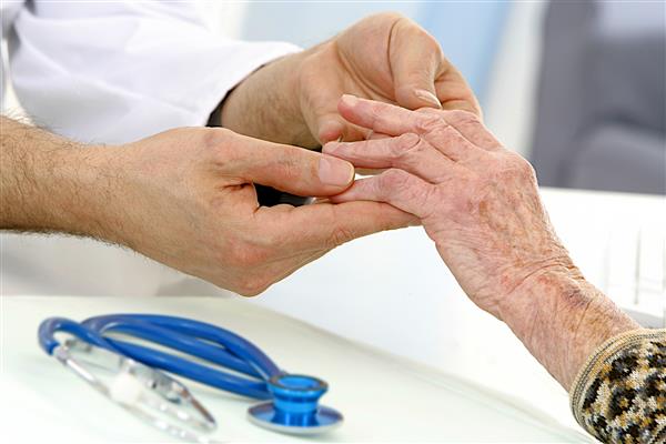 ویزیت پزشکی - مراقبت از سالمندان - آرتروز جرات تغییر شکل