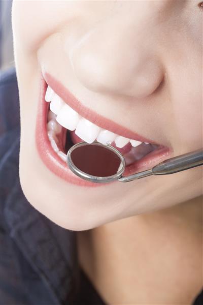 بررسی دندان های بیمار بیمار با استفاده از آینه دندان دهان ترکیب تصویر عمودی