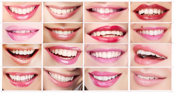 مجموعه لب های زنان لبخندهای دندانی رژ لب