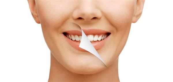 مفهوم زیبایی و سلامت دندان - زن زیبا با دندانهای سفید قبل و بعد