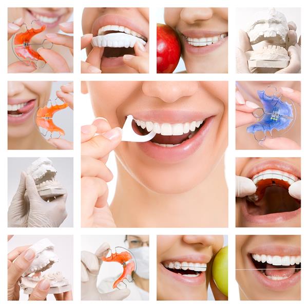 کلاژ عکس با موضوع مراقبت از دندان و دندان های سالم خدمات دندانپزشکی