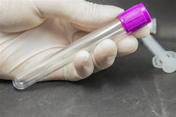 EDTA لوله جدید خون برای آزمایش بار ویروسی در آزمایشگاه