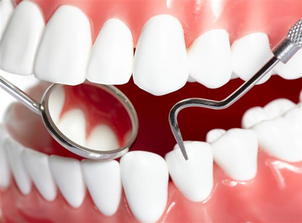 دندانهای انسان سالم و آینه دهان دندانپزشک