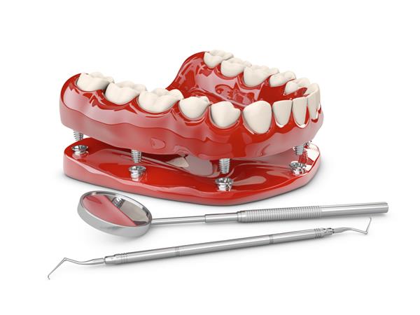 دندان انسان و ایمپلنت دندان تصویر سه بعدی