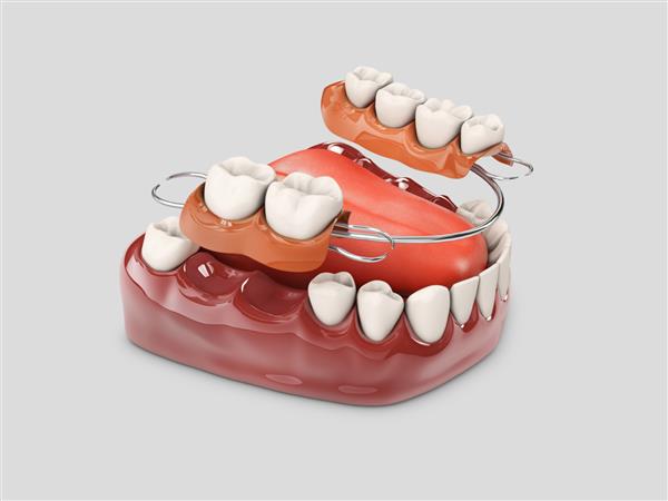 دندان های انسان با دندان مصنوعی تصویر سه بعدی سفید جدا شده