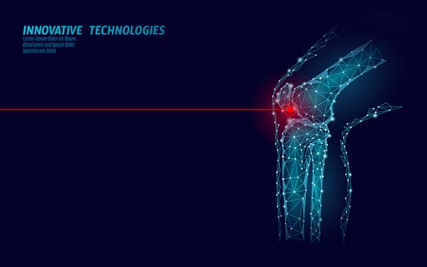 تصویر وکتور مدل سه بعدی مفصل زانو انسان درمان درد با تکنولوژی آینده با طراحی کم پس زمینه آبی و الگوی پزشکی پای بدن مرد آسیب دیدگی قرمز