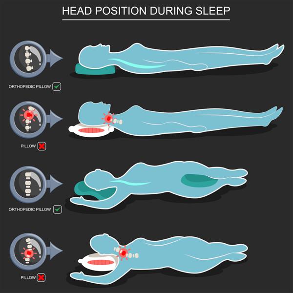 بالش های ارتوپدی برای موقعیت صحیح سر در هنگام خواب