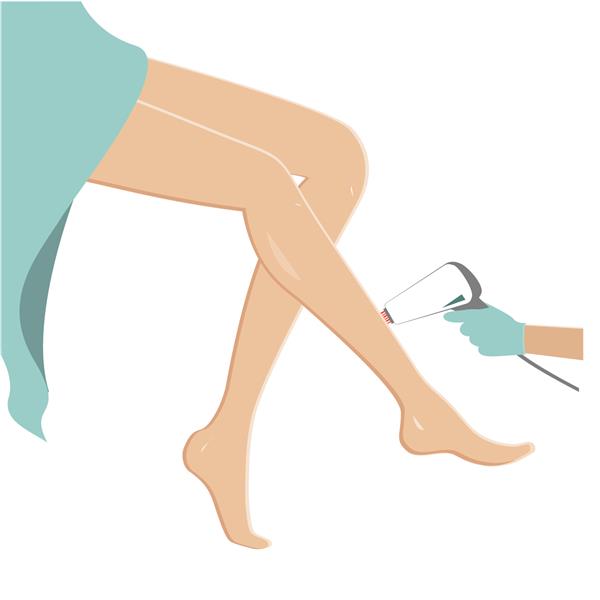 رفع موهای زائد پاهای زنانه مفهوم اپیلاسیون لیزری تصویر برداری مسطح