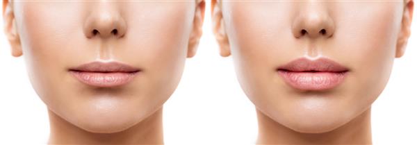 لب های زنانه قبل و بعد از فیلر بزرگ کردن لب کامل و لب نازک آرایش دائمی دهان زنان از نزدیک روی پس زمینه سفید